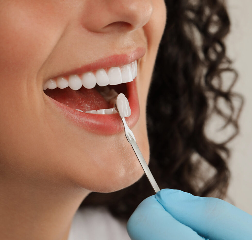 Treatment -  Belmont House Dental