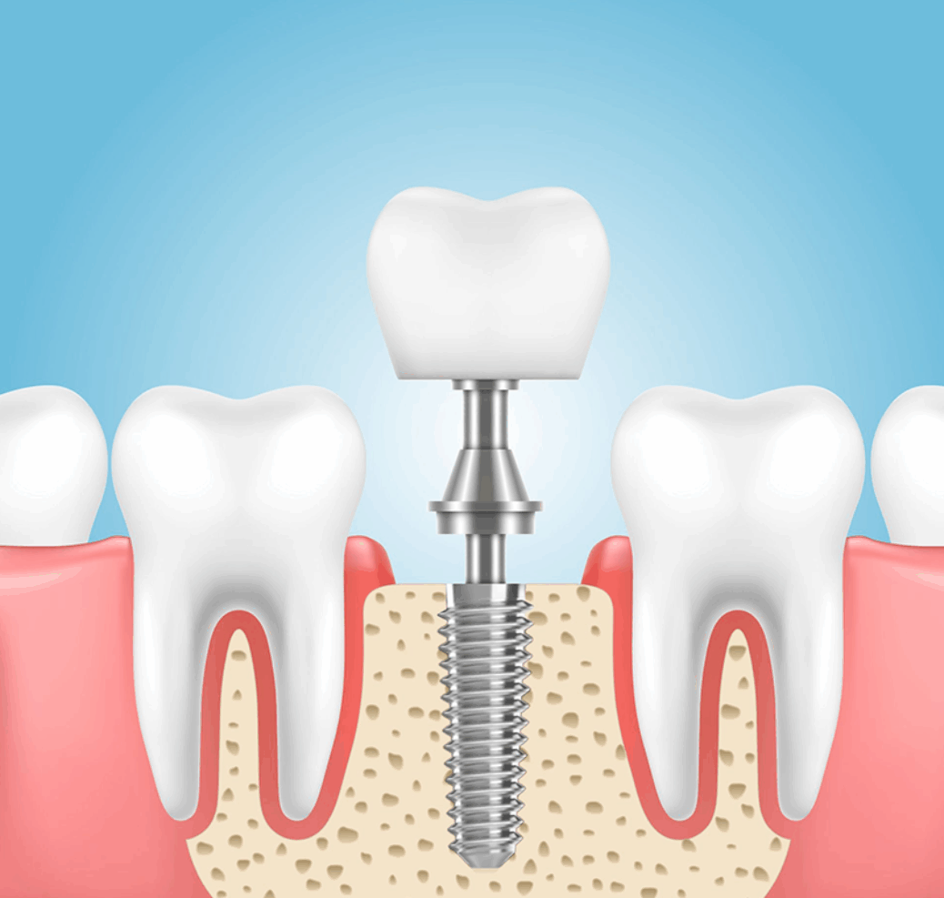 Treatment -  Belmont House Dental