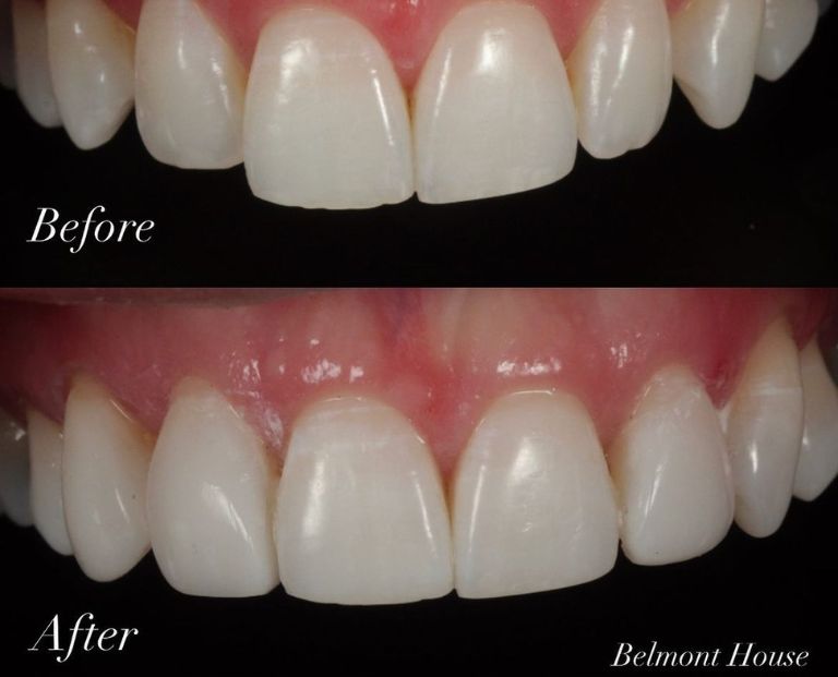 Belmont House Dental